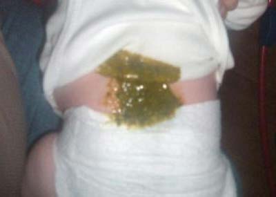 مدفوع نوزاد,انواع مدفوع نوزاد,مدفوع واقعی نوزاد